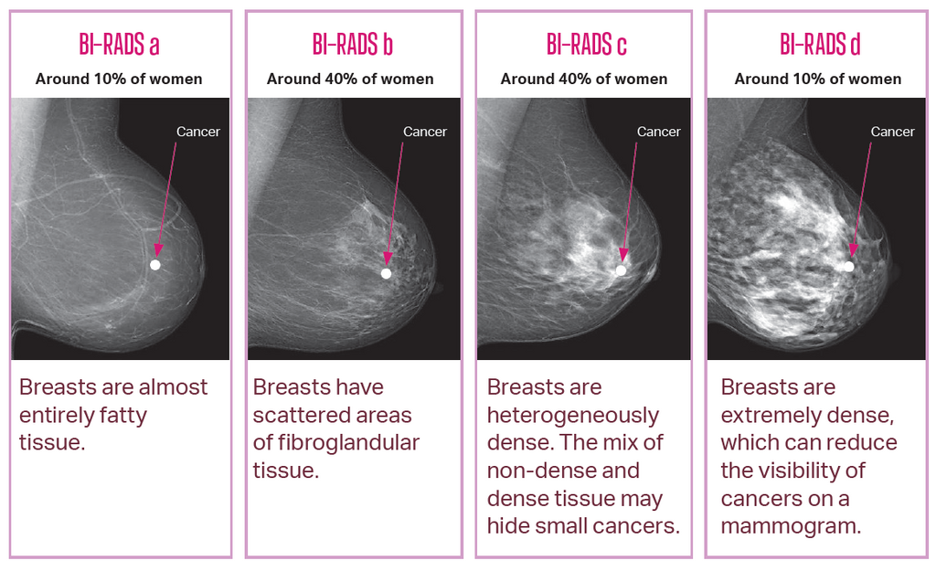 Breastscreen Sa Breast Density